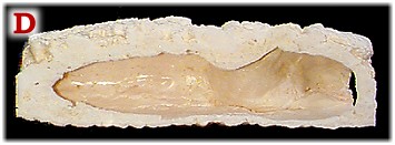Side View
